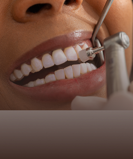 Professional Teeth Cleaning & Hygiene Care