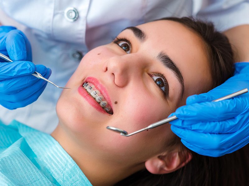 braces