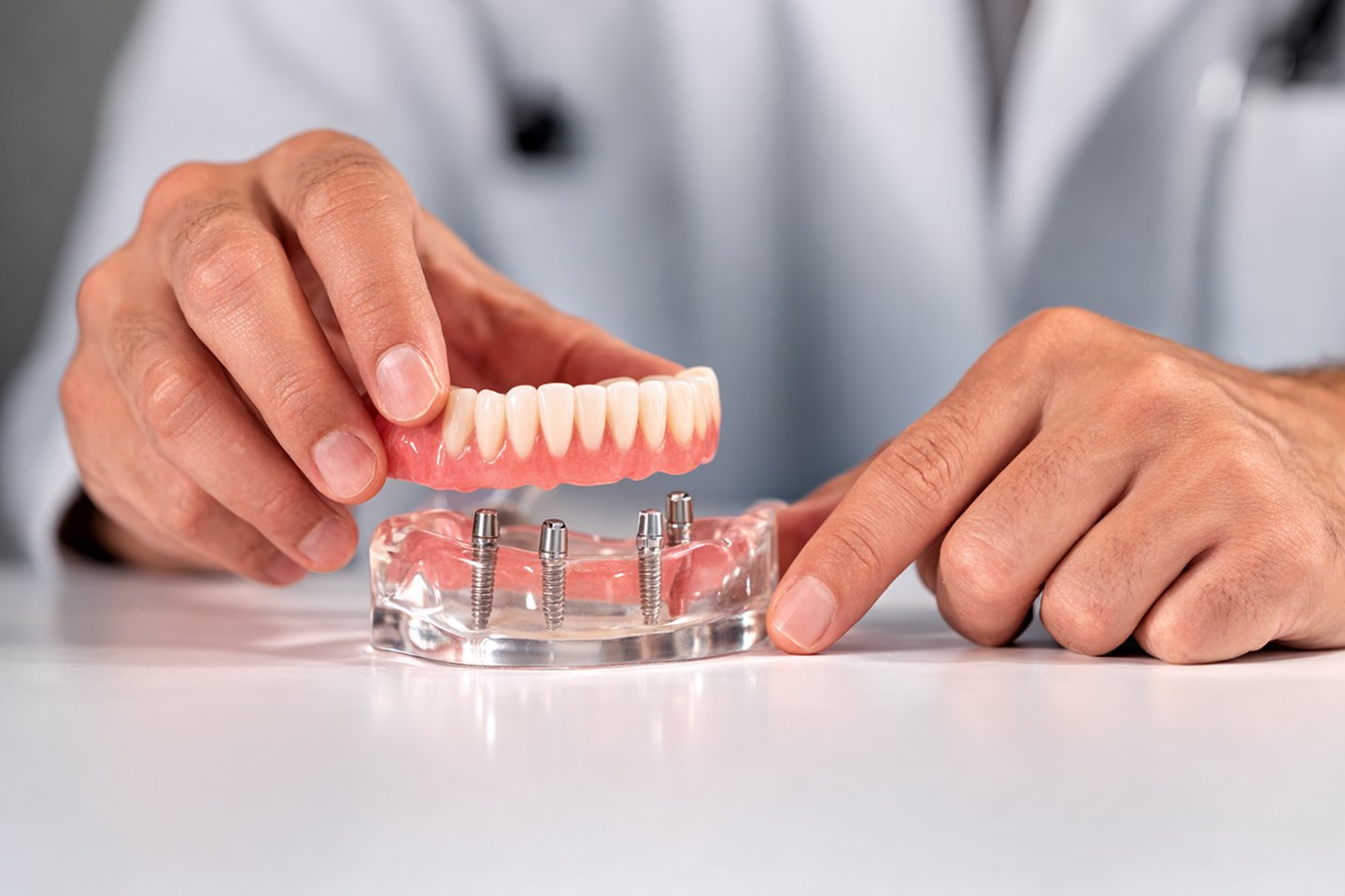 All-on-4 Dental Implants Cost in South Windsor NSW: 2026 Price Guide | What to Expect